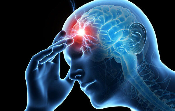 Migraine